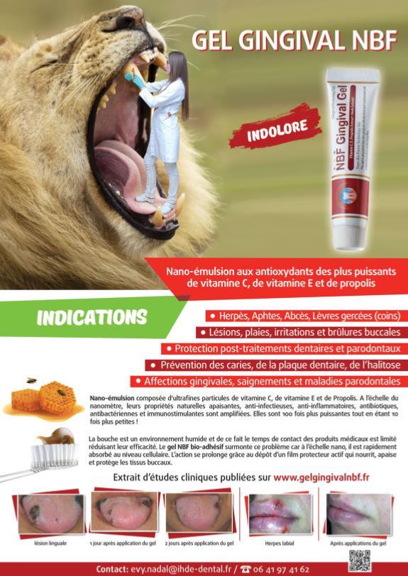 Poster Gel Gratuit